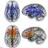 Мозг женщины и мозг мужчины различия и сравнения любопытные факты Мужской и женский мозг